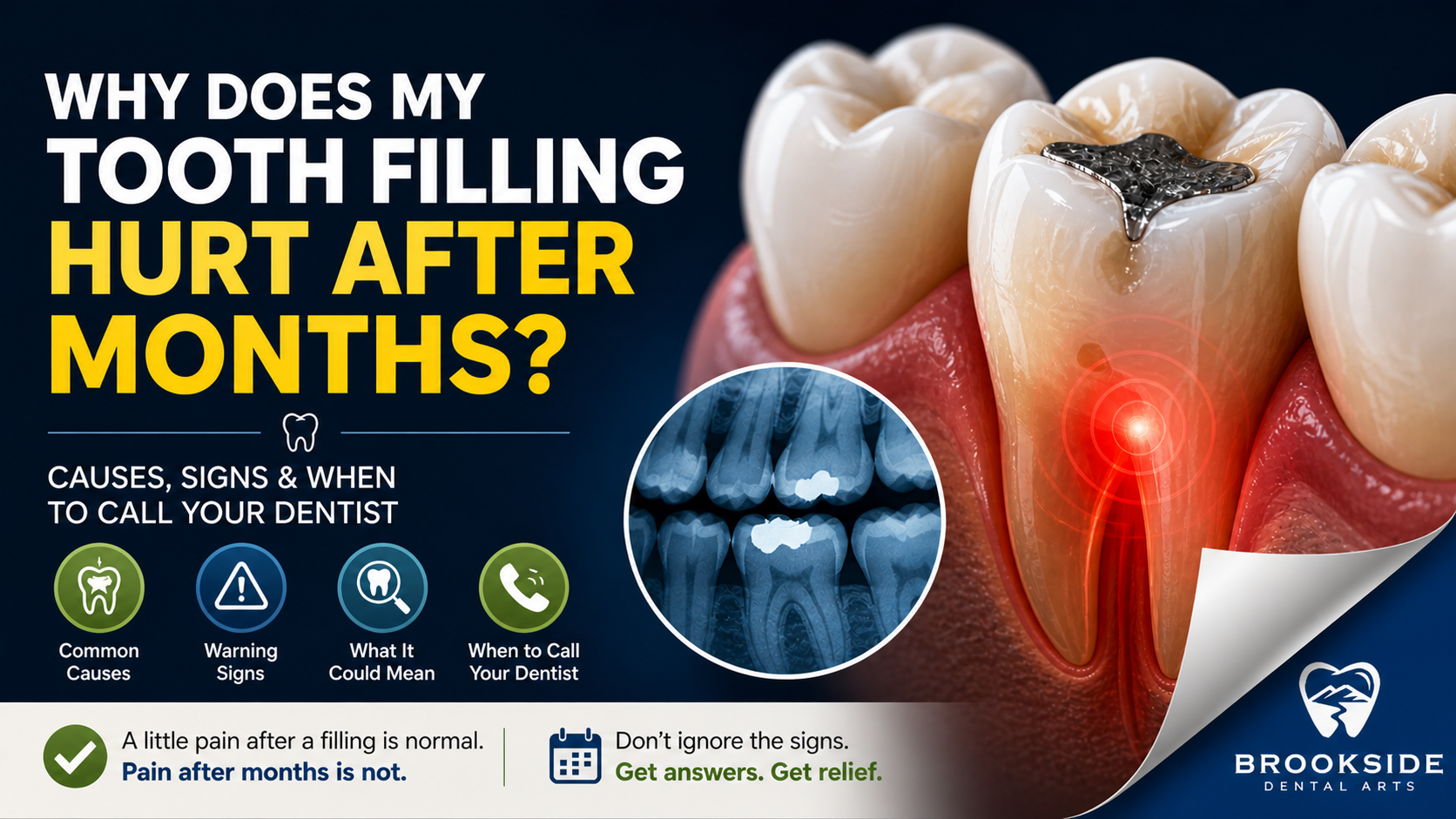Why Does My Tooth Filling Hurt After Months