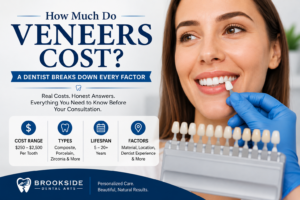 How Much Do Veneers Cost