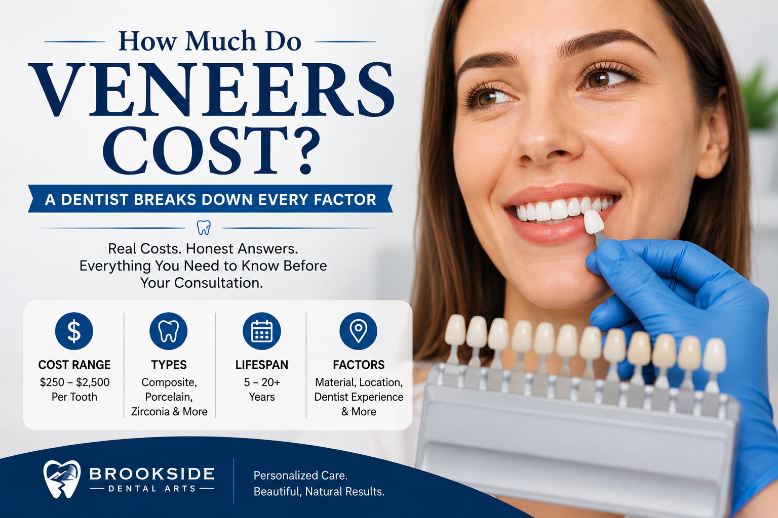 How Much Do Veneers Cost